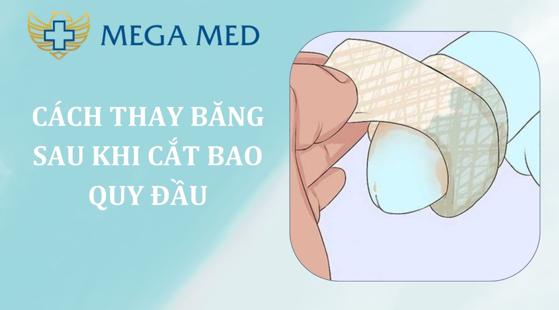 Cách thay băng sau khi cắt bao quy đầu